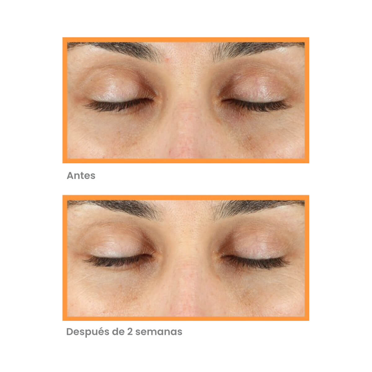 RAPID DARK SPOT CORRECTING SERUM (SUERO INTENSIVO ANTIMANCHAS CON ÁCIDO GLICÓLICO)